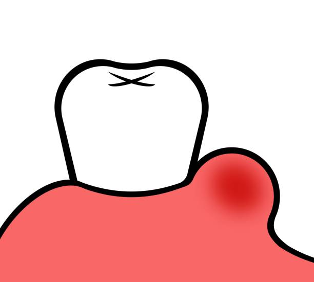 Bleeding and Swelling