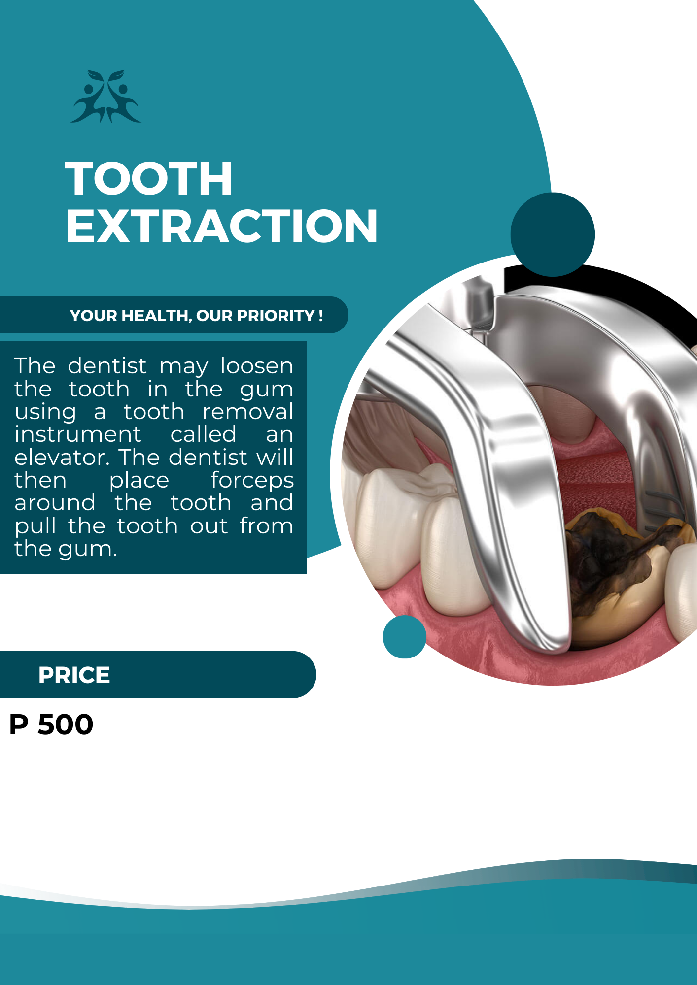 Tooth Extraction
