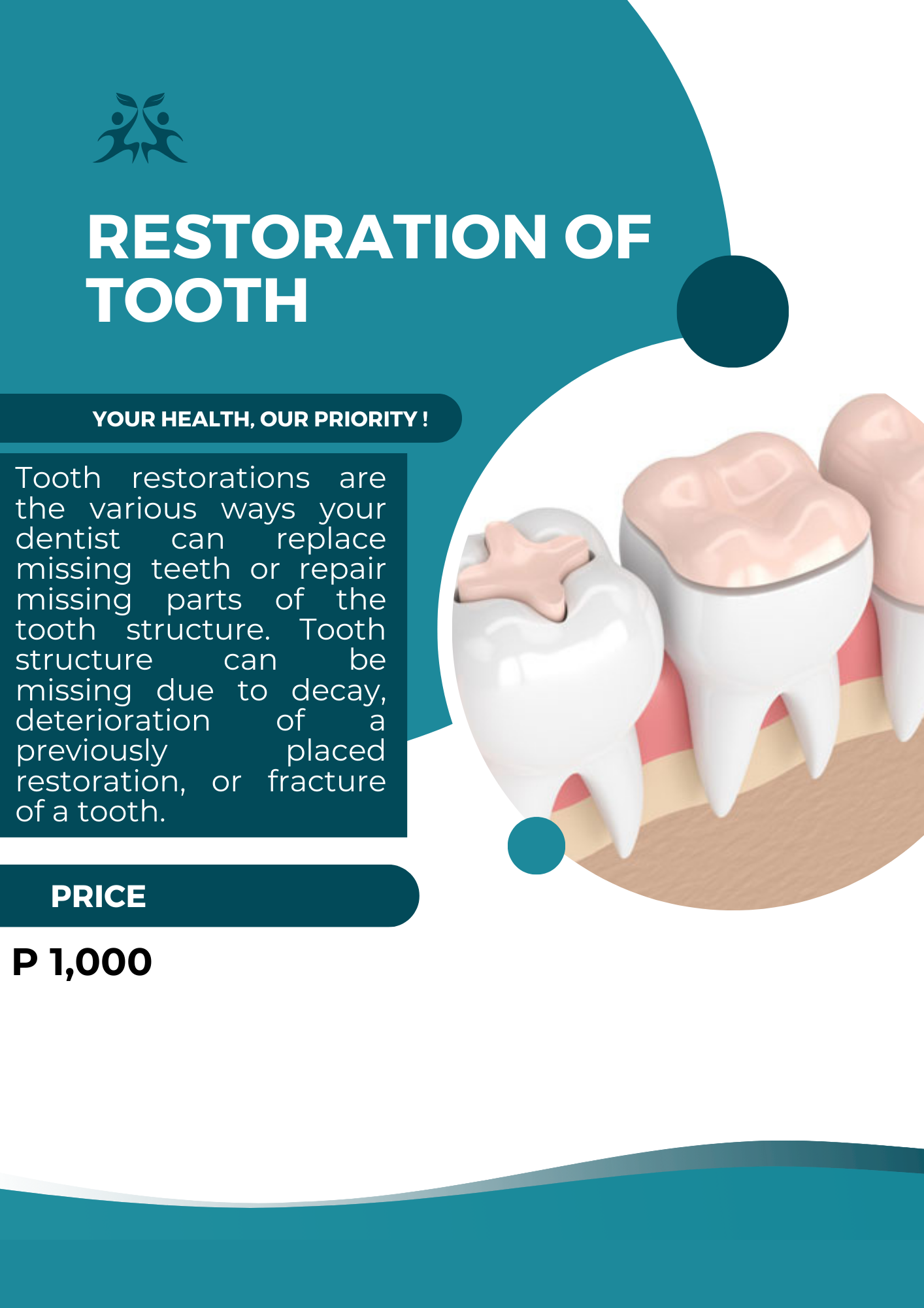 Restoration of Tooth